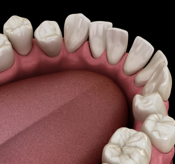 Animated smile with crooked teeth before orthodontic care