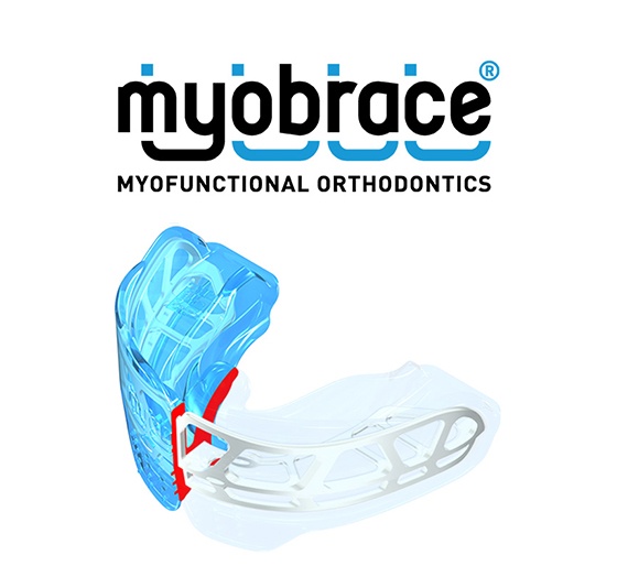 Myobrace myofunctional orthodontics appliance