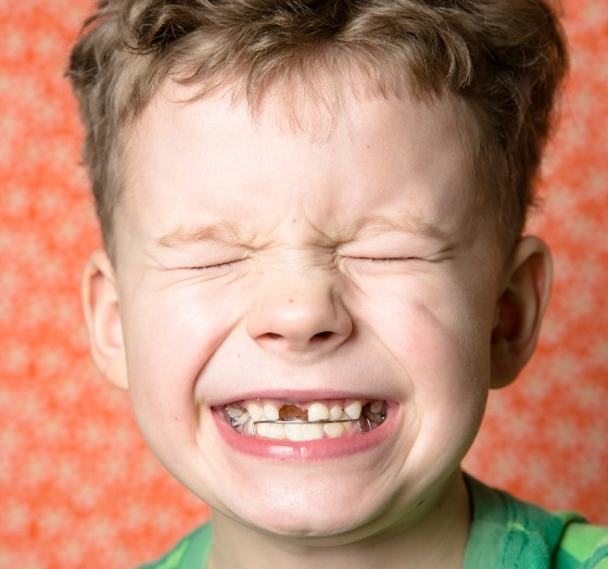 Young child with dentofacial orthopedics appliance smiling