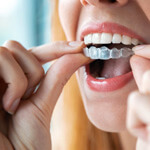 a person putting on their invisalign aligners