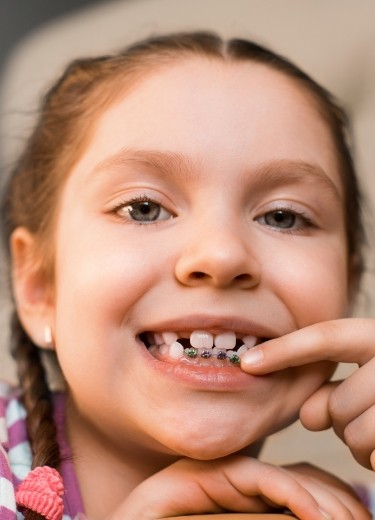 Child pointing to her phase one pediatric orthodontics appliance