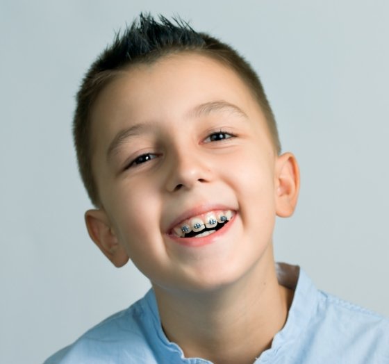 Smiling child with phase one orthodontics in place