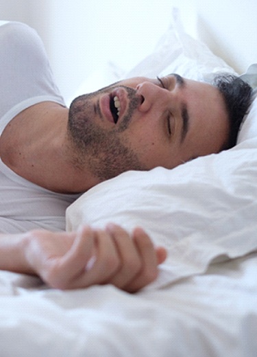 Man with sleep apnea in Palm Harbor, FL lying on back snoring
