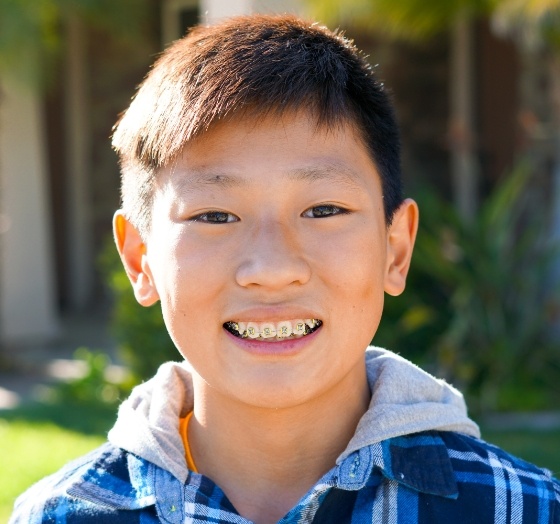 Young man with traditional braces smiling