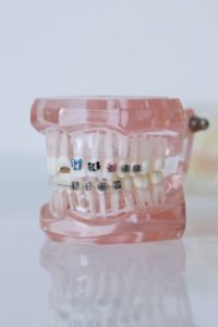 Dental model used for braces