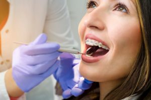 A dentist with blue gloves holding a mirror in the mouth of a woman with brown hair and eyes with braces