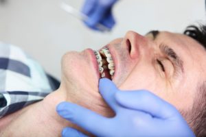 Middle aged man in dental chair with braces with dentist's blue gloved finger pulling his lip back