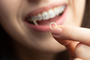 Patient with braces holding a rubber band up to the camera